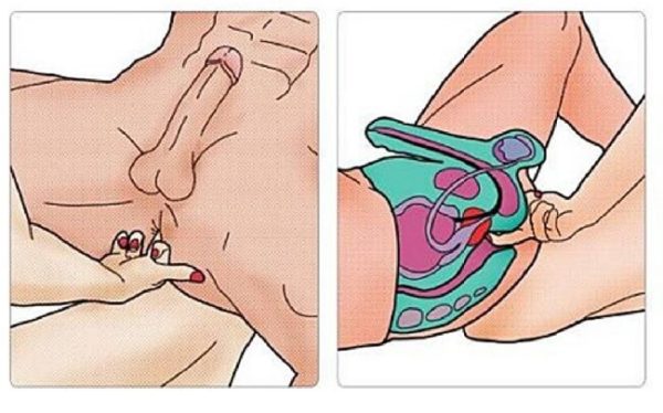 Полезен ли массаж простаты, техника выполнения