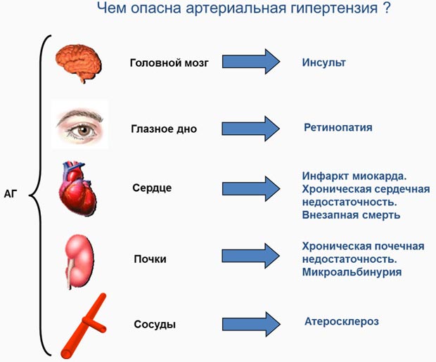 Гипертоническая болезнь (гипертония)