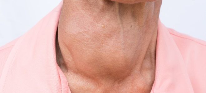 Щитовидная железа симптомы болезни