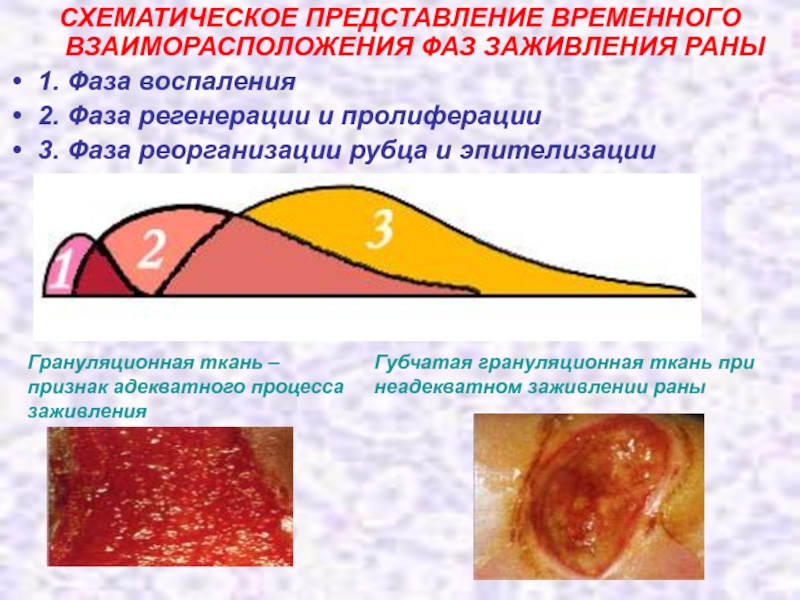 Грануляция раны фото