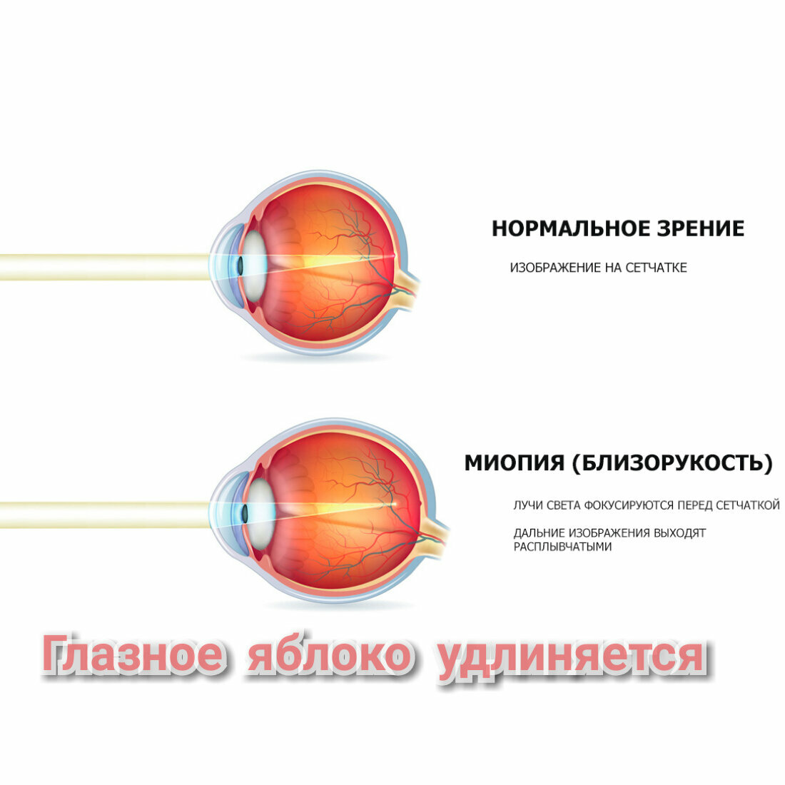 Глаз — википедия. что такое глаз