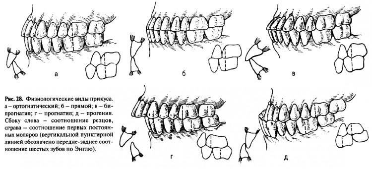 Патологический (неправильный) прикус зубов у взрослых и детей
