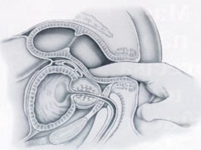 Полезен ли массаж простаты, техника выполнения