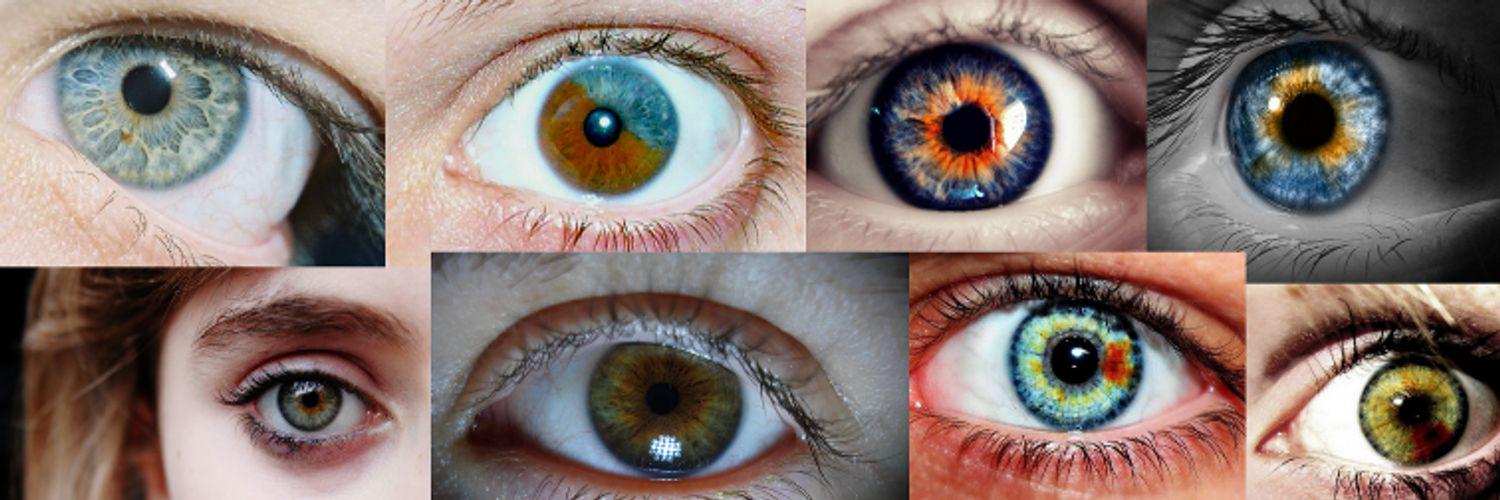 Что такое гетерохромия и и что могут сказать о человеке глаза разного цвета