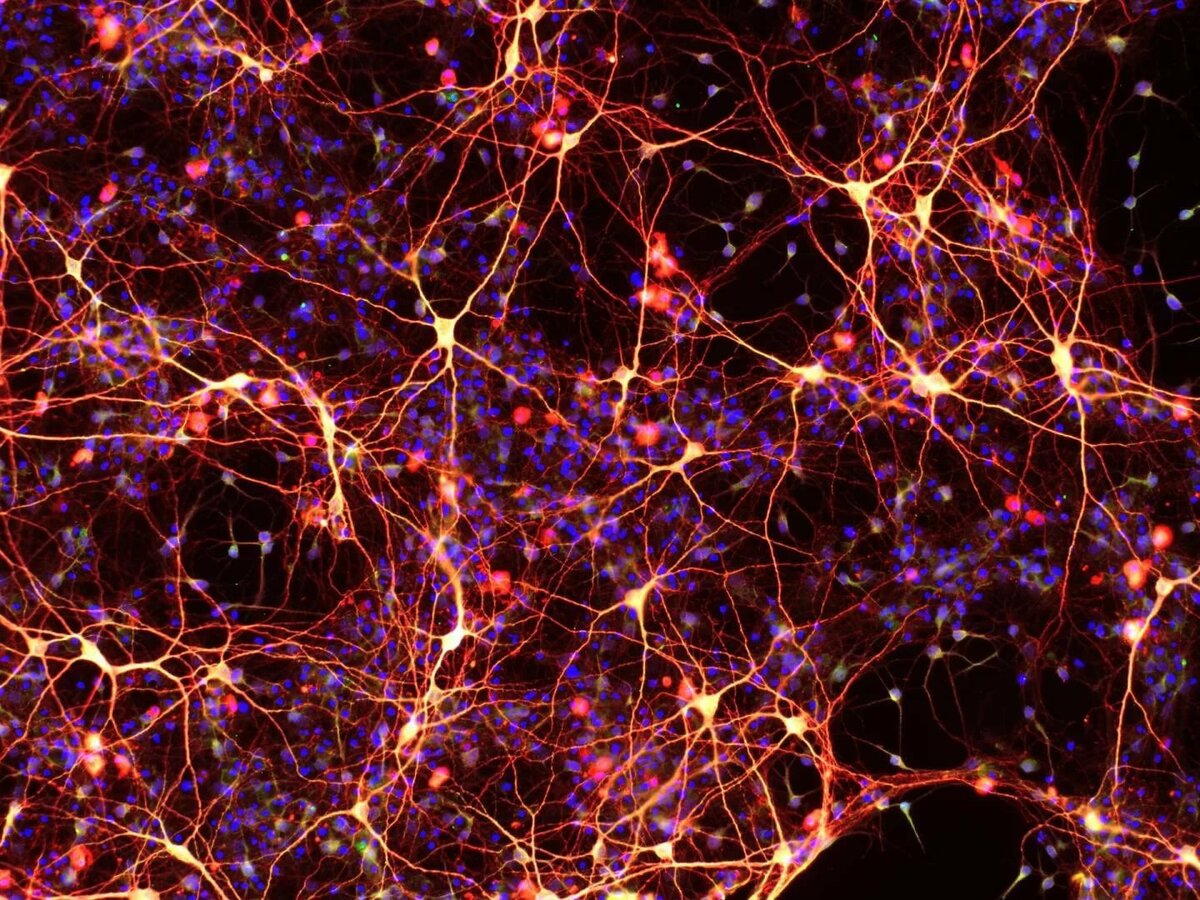 Нейроны - что это такое, их виды и функции