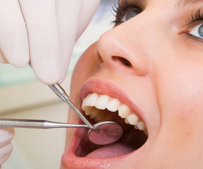 Санация полости рта, особенности проведения