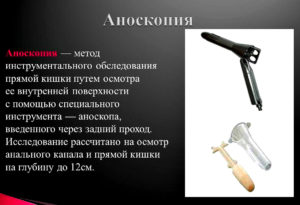 Аноскопия в москве - подготовка к обследованию и процедуре
