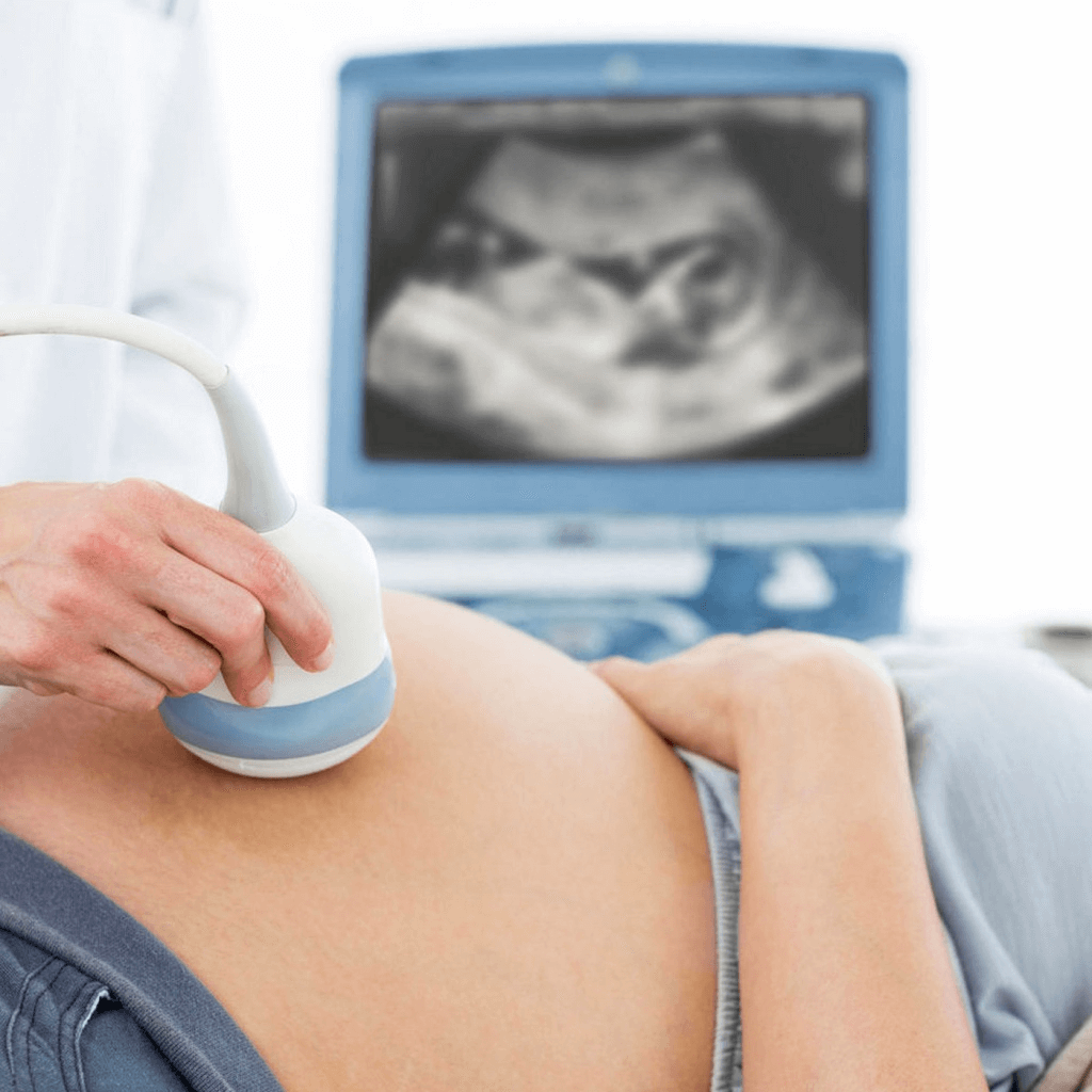 Допплерография при беременности: показания, как расшифровывается, вредно ли