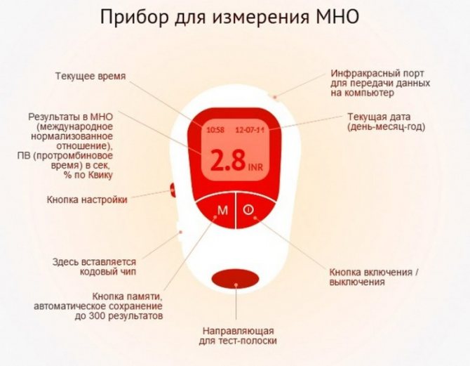 Что такое мно: норма, методы контроля