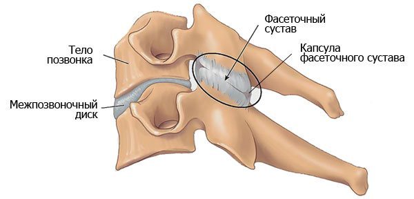 Спондилоартроз шейного отдела позвоночника что это такое