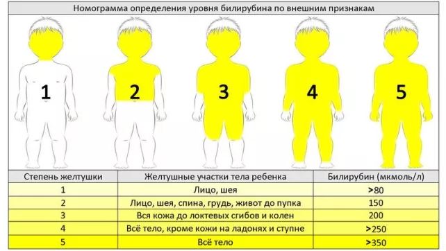 Что такое гипербилирубинемия?