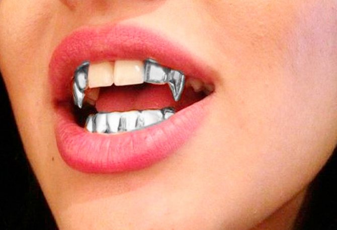 Грилзы на зубы: что это такое? история возникновения украшения